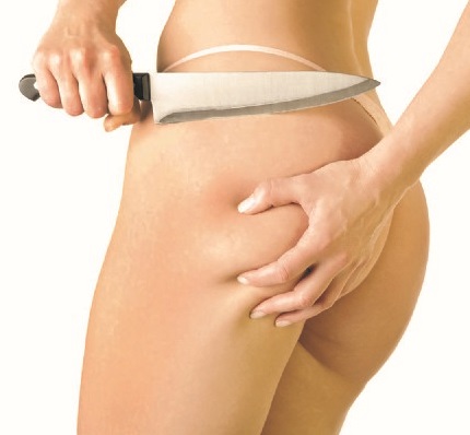 Imagem do Tratamento: Culote