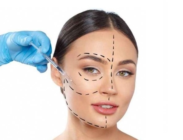 Imagem do Tratamento: Harmonização Facial